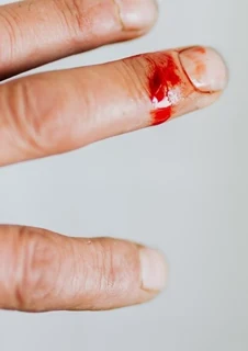 En hand som har ett blodigt skärsår på ringfingret. 