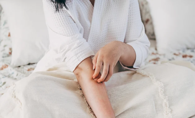 Kvinna som sitter i en säng och kliar sig på grund av en allergisk reaktion.