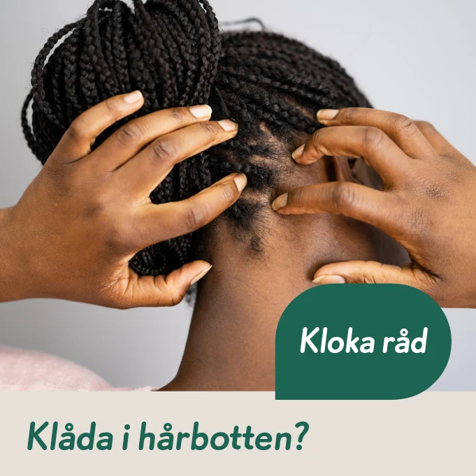 Kloka råd: Klåda i hårbotten?