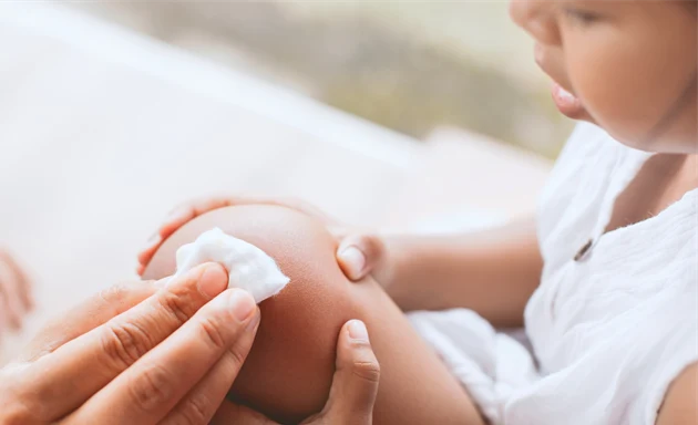 En förälder baddar försiktigt ett barns knä med en bomullstuss, antagligen efter ett sår.