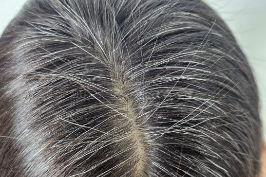 Grått hår i närbild.