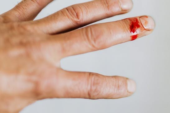 En hand som har ett blodigt skärsår på ringfingret.