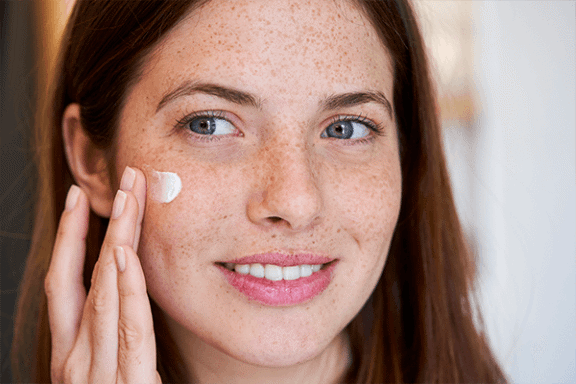 Tjej med känslig hud som applicerar en kräm.