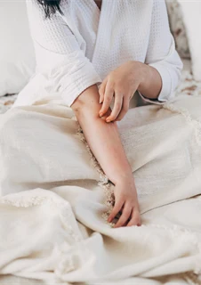 Kvinna som sitter i en säng och kliar sig på grund av en allergisk reaktion.