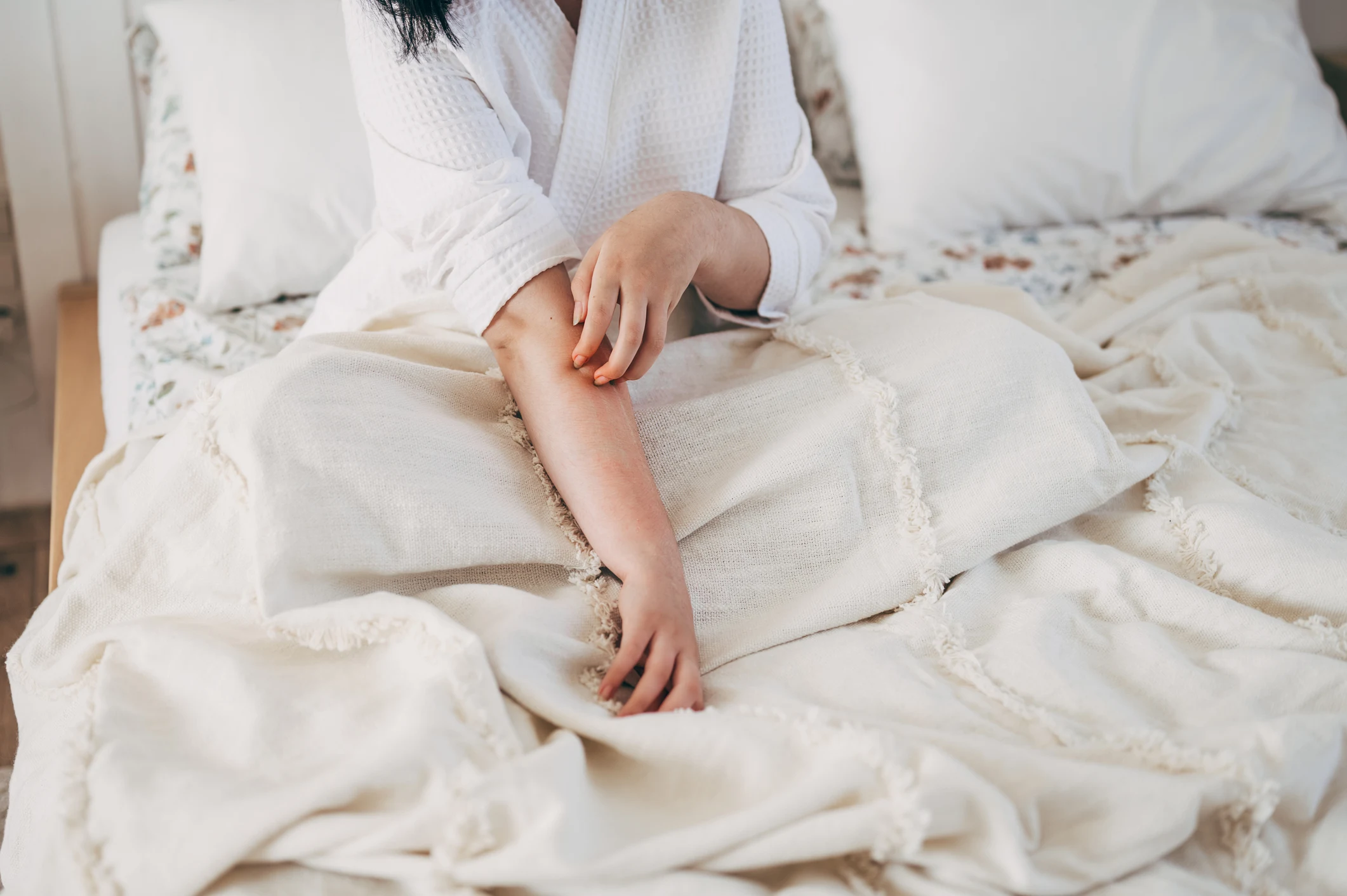 Kvinna som sitter i en säng och kliar sig på grund av en allergisk reaktion.