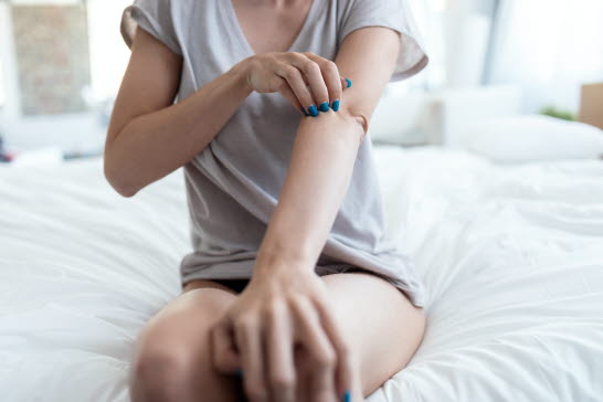Psoriasis kommer ofta i skov.